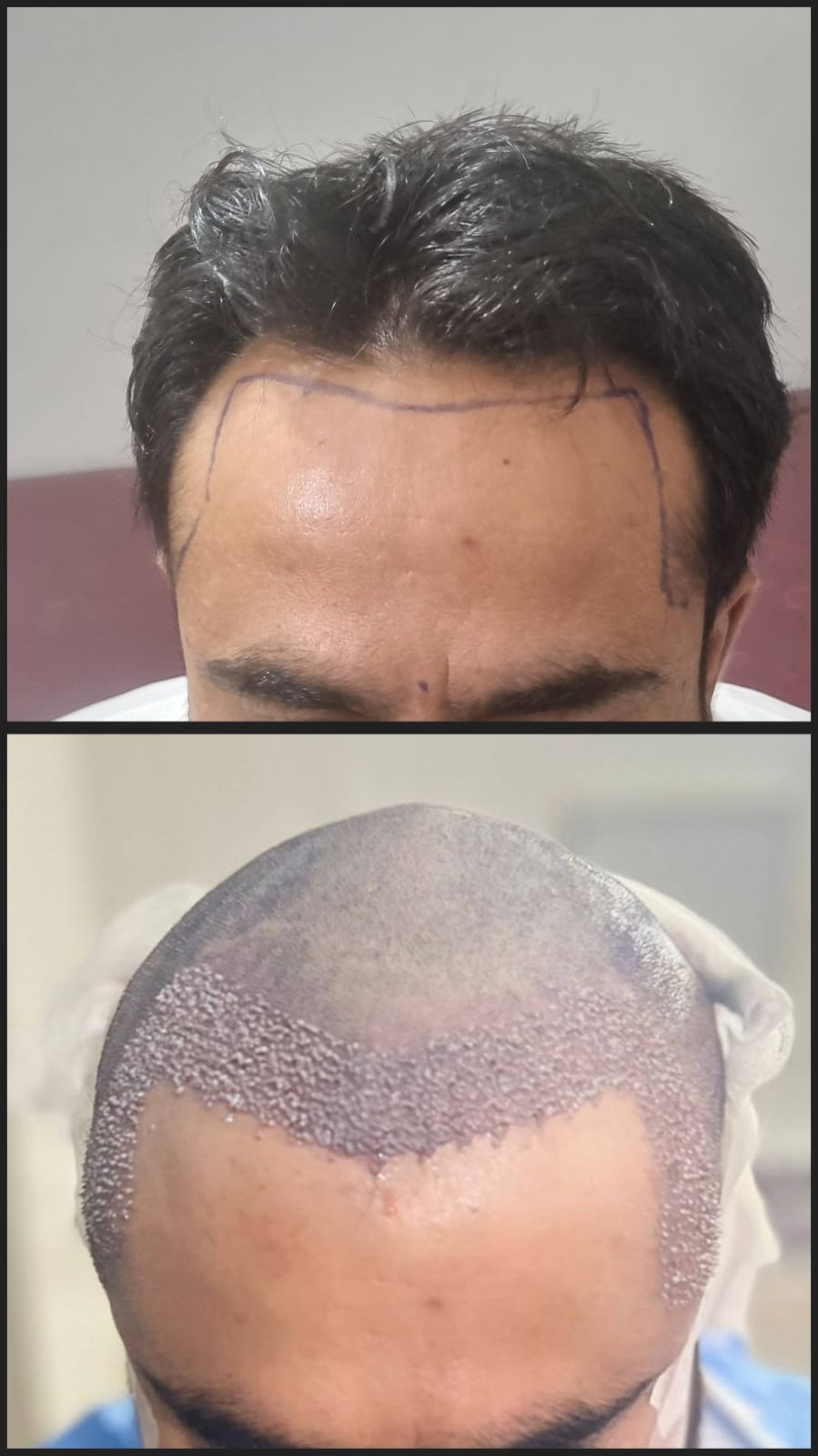 Before & After 14